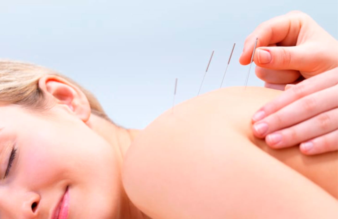 Richard Leigh Chartered Physiotherapist - Acupuncture